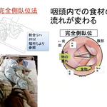 口腔から全身へ深刻化するフレイル、口腔ケアと運動で予防する