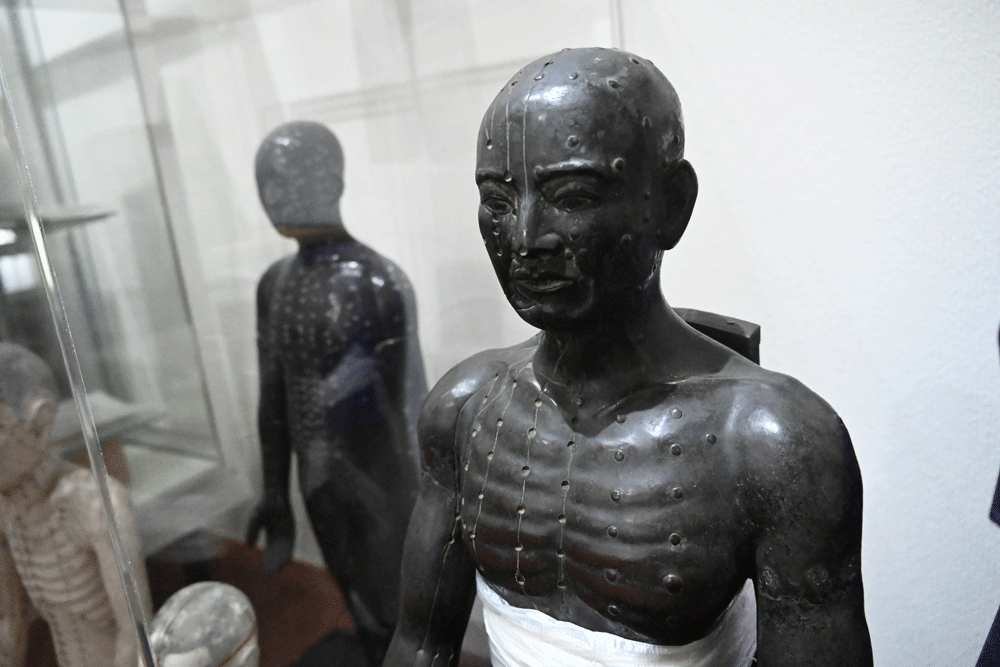 戦時の「金属類回収」を逃れ、銅製の経穴人形が残っているのは珍しいこと